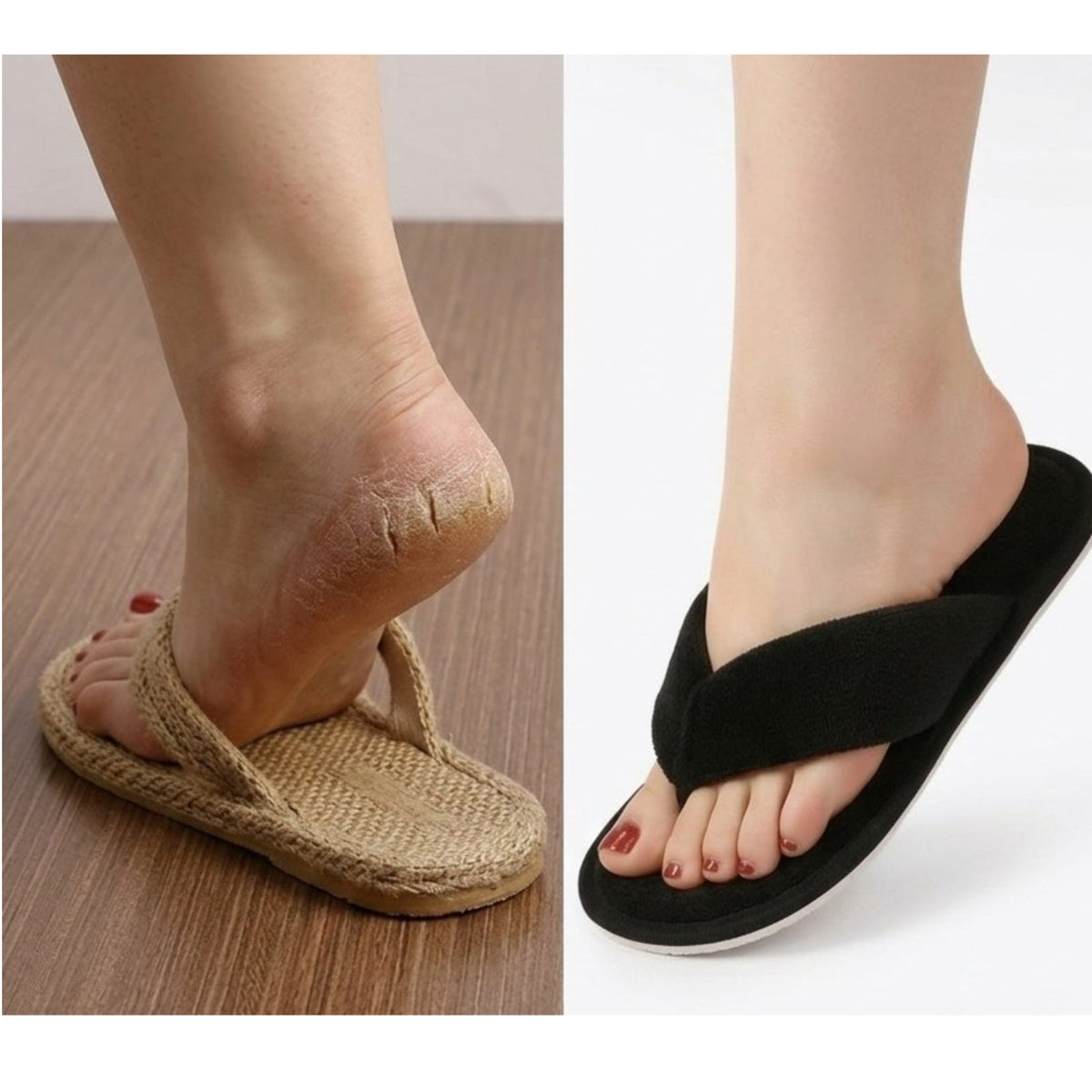 SilkHeal Therapy Slippers : Medicated Heel Care Slippers By KakuBaku