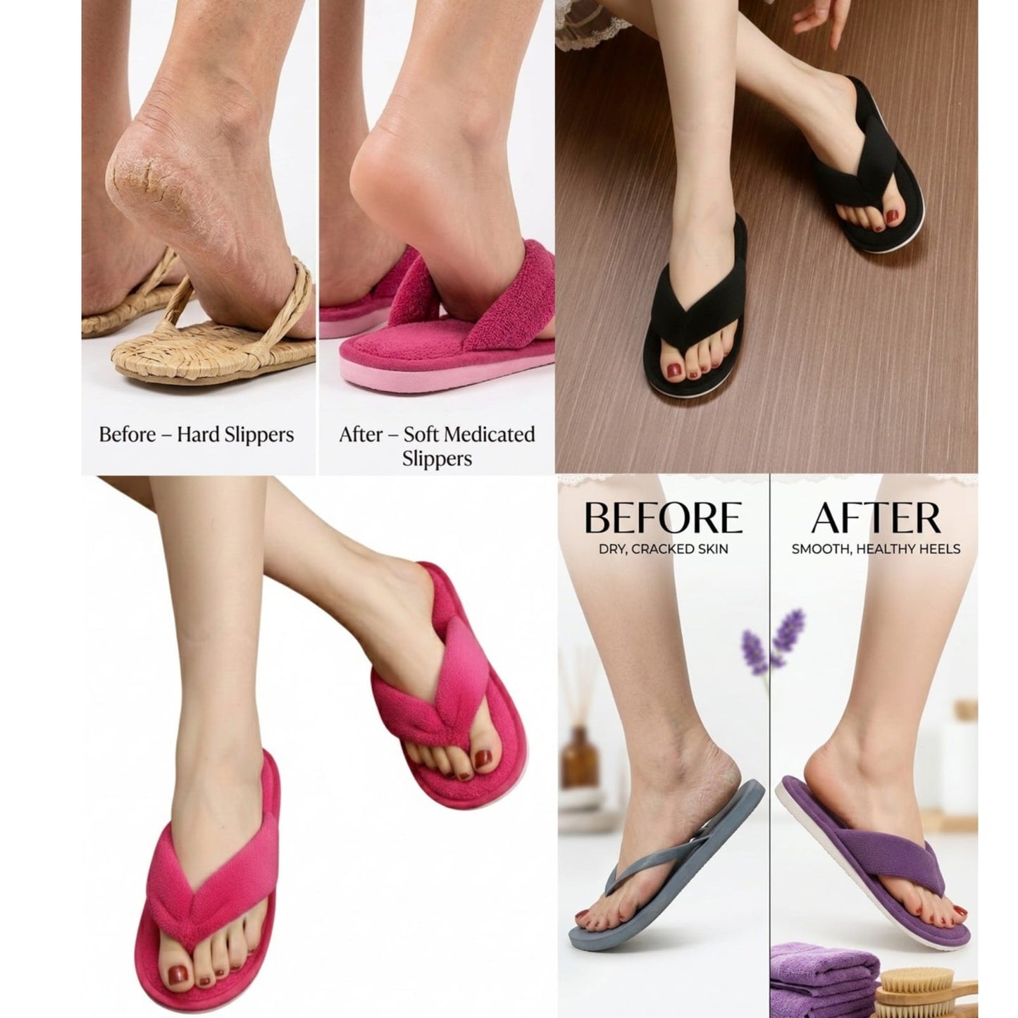 SilkHeal Therapy Slippers : Medicated Heel Care Slippers By KakuBaku